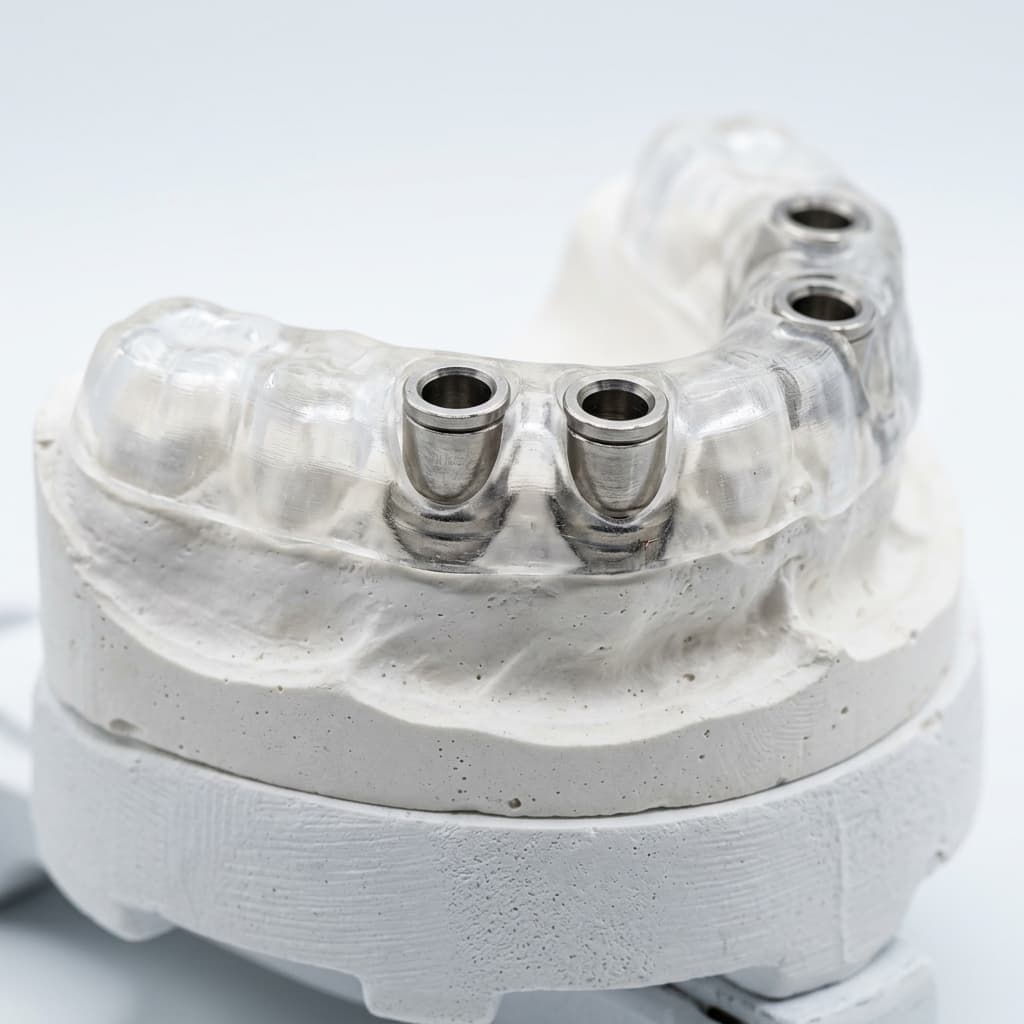 Implant Planning & Guides